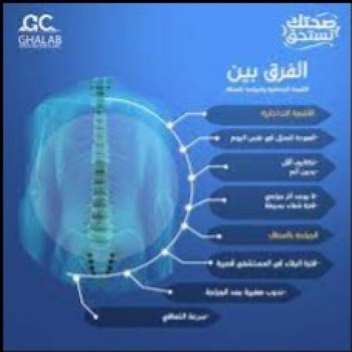مركز أشعة تداخلية بالاسكندرية 
